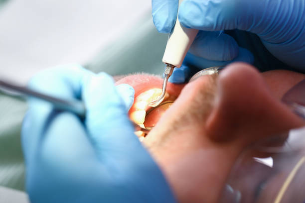 Best Emergency Tooth Extraction in Sturtevant, WI
