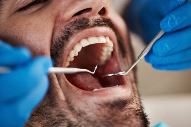 Best Emergency Root Canal Treatment in Sturtevant, WI