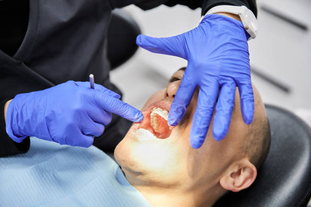 Best Emergency Wisdom Teeth Removal in Sturtevant, WI