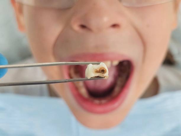 Best Pediatric Emergency Dentist in Sturtevant, WI