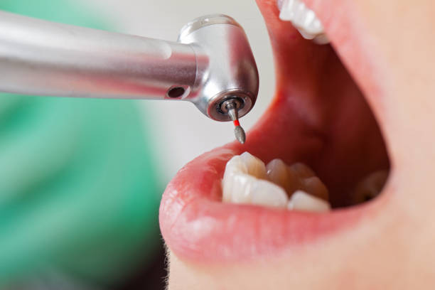 Best Pediatric Emergency Dentist in Sturtevant, WI